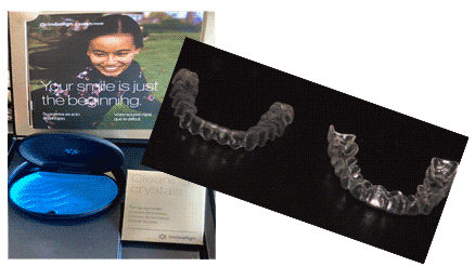 image of invisalign scanning